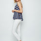 Remy Top